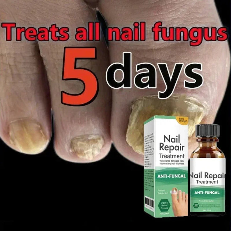 Fast Nail Fungal Treatments Nail Repair Essences Serum