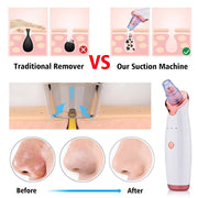 Face Vacuum Blackhead Remover Pore Cleaner | Electric Deep Cleansing Tool For Nose & Face