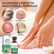 Fast Nail Fungal Treatments Nail Repair Essences Serum