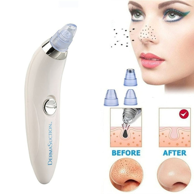 Derma Suction Blackhead Remover Vacuum Suck The Yuck Out Of Your Pores (cell Operated )