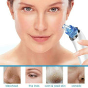 Derma Suction Blackhead Remover Vacuum Suck The Yuck Out Of Your Pores (cell Operated )