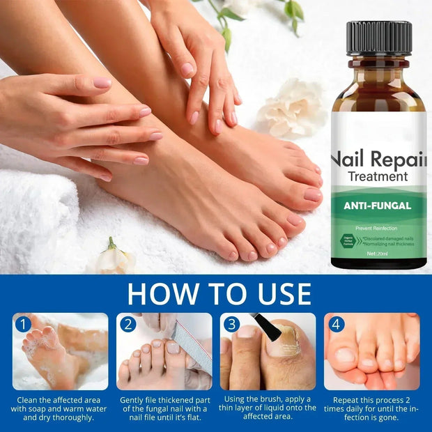 Fast Nail Fungal Treatments Nail Repair Essences Serum