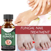 Fast Nail Fungal Treatments Nail Repair Essences Serum